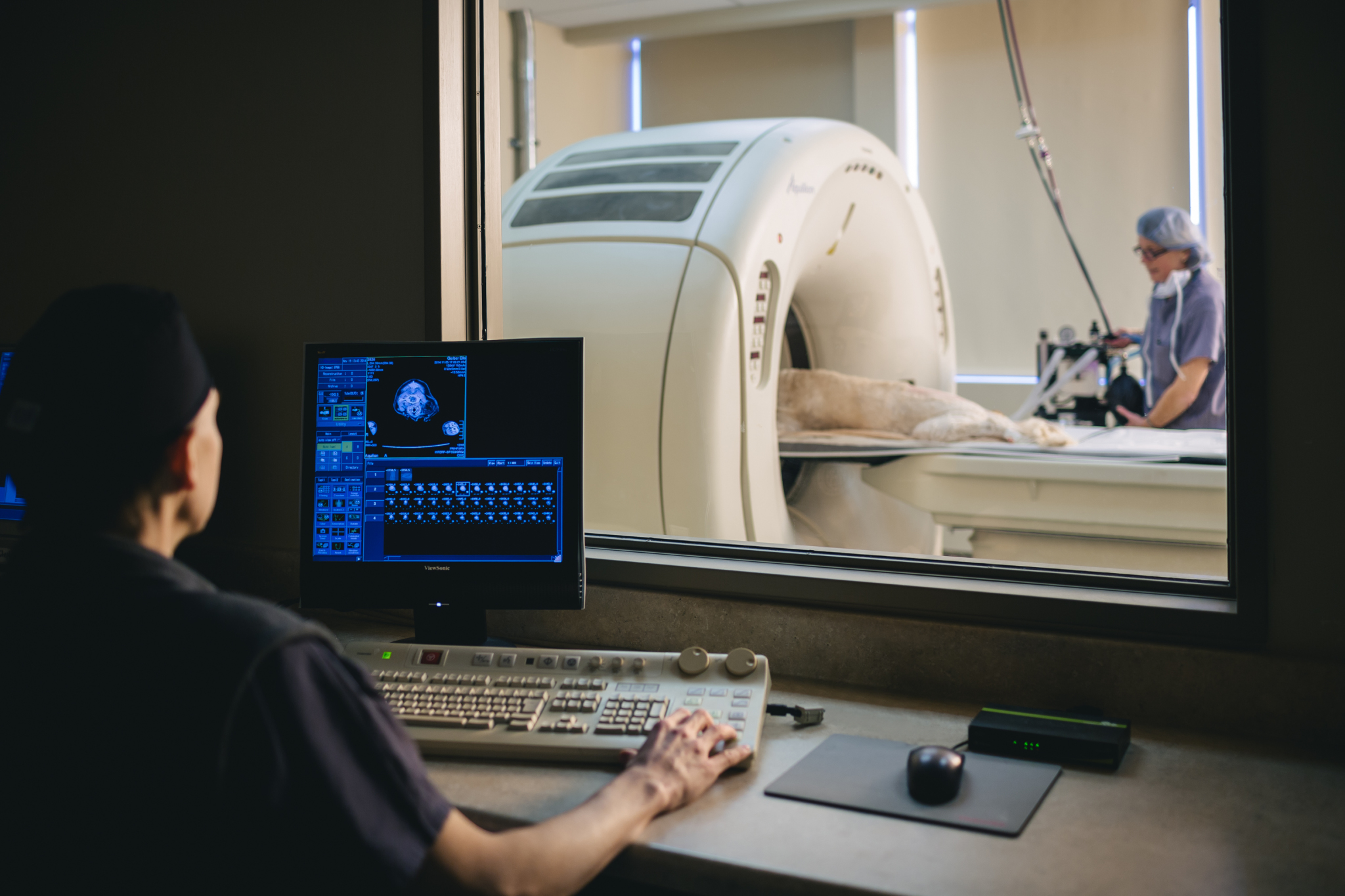 Computed Tomography (CT) Scan
