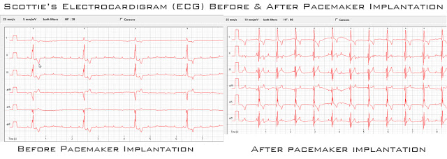 ECG