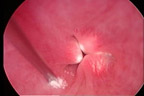 Urinary image two