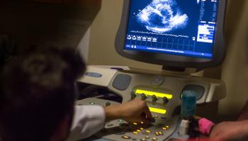 Echocardiography